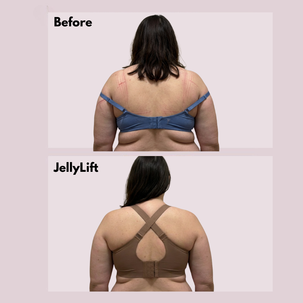 Say goodbye to discomfort and pain with JellyLift™