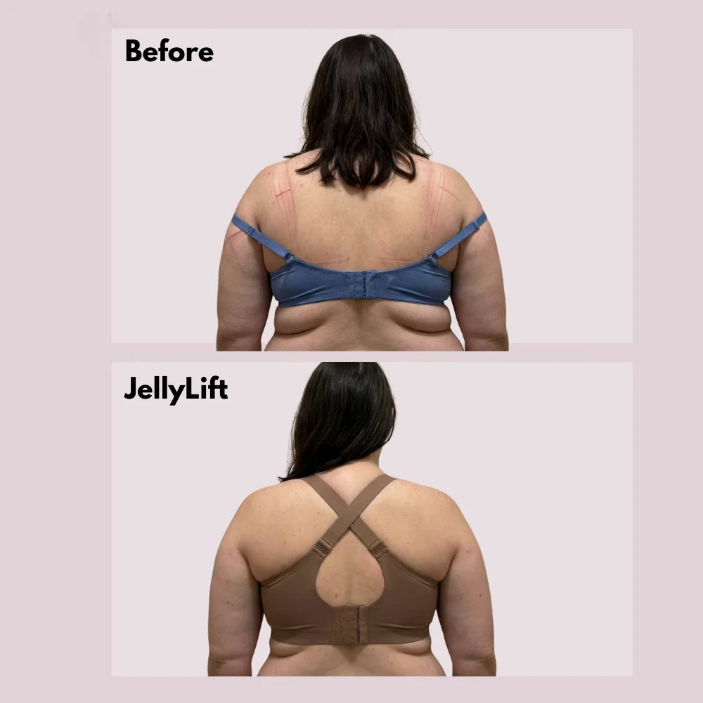 Diga adiós a la incomodidad y al dolor gracias a JellyLift™