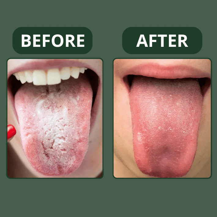 Arganova | Oregano Oil Capsules