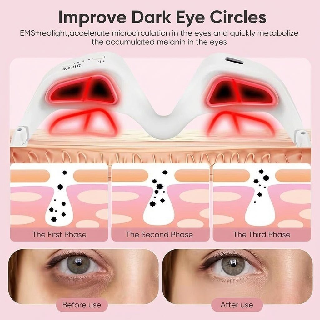 AuraEyes™ 2 en 1: Terapia de luz roja + EMS para reducir las bolsas bajo los ojos