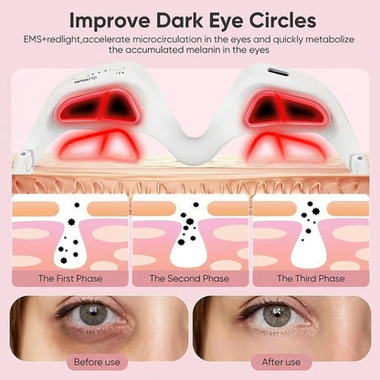 AuraEyes™ 2 en 1: Terapia de luz roja + EMS para reducir las bolsas bajo los ojos