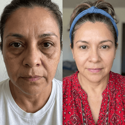 AuraEyes™ 2 en 1: Terapia de luz roja + EMS para reducir las bolsas bajo los ojos