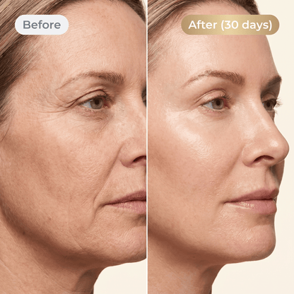 CollagenLift™ kollagenfastande spray