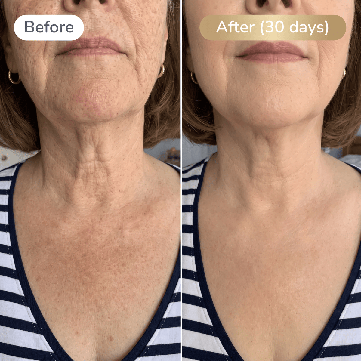 CollagenLift™ kollagenfastande spray