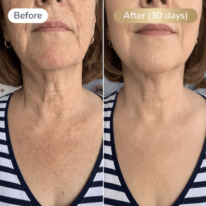 CollagenLift™ kollagenfastande spray