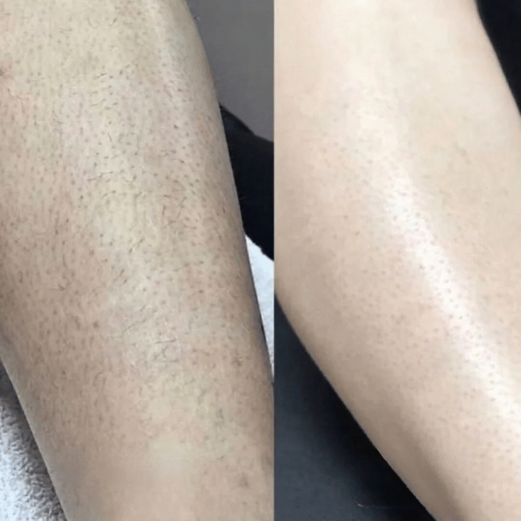 GlowShave 2.0
