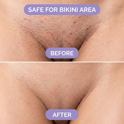 Silky - l’épilation la plus simple et sans douleur pour une peau lisse instantanément !