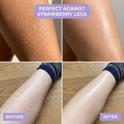 Silky - l’épilation la plus simple et sans douleur pour une peau lisse instantanément !