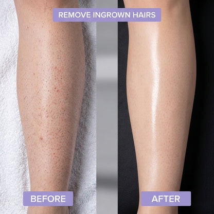 Silky - l’épilation la plus simple et sans douleur pour une peau lisse instantanément !