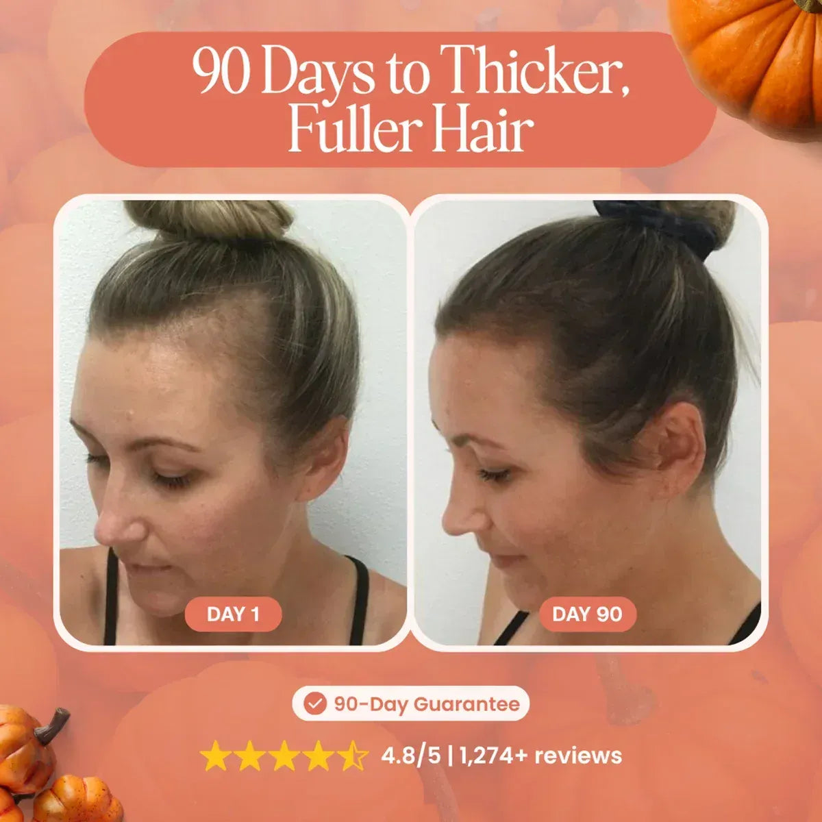 HairBloom™ - Marre de la perte de cheveux ? Neutralisez la cause hormonale interne et regagnez en épaisseur !
