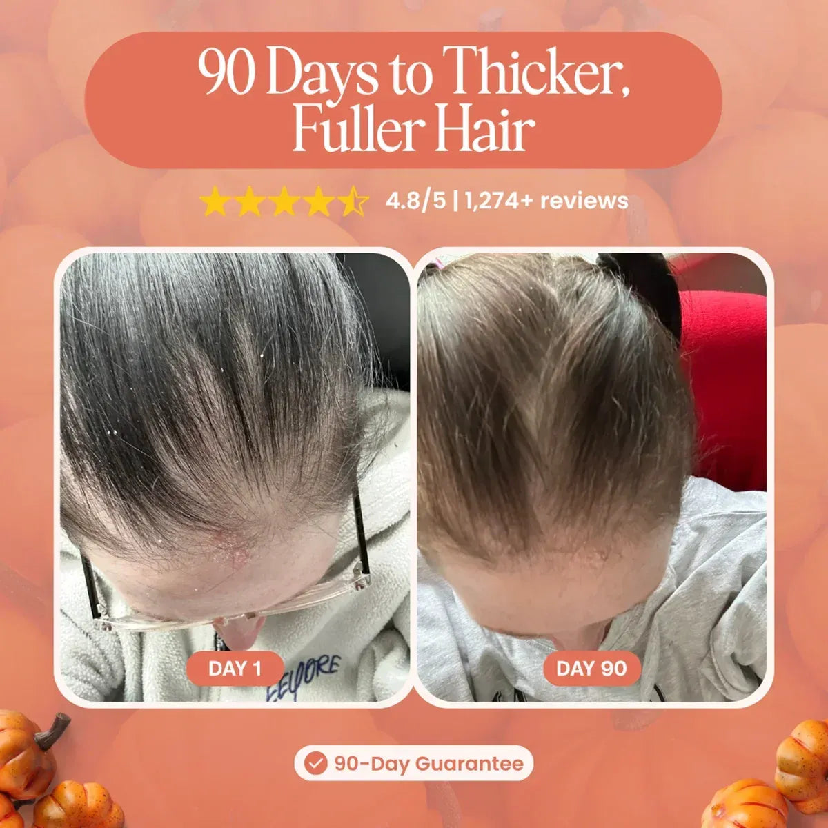 HairBloom™ - Marre de la perte de cheveux ? Neutralisez la cause hormonale interne et regagnez en épaisseur !